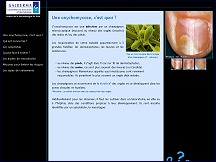 Aperu du site Ongles Malades - informations sur les onychomycoses