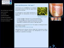 Ongles Malades - informations sur les onychomycoses