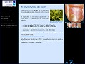 Détails Ongles Malades - informations sur les onychomycoses